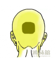 骨相大全—四方金印骨