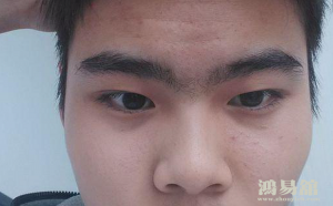 眉毛相交命运怎么样？眉毛相交的男人面相