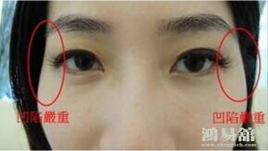 夫妻宫是什么意思，夫妻宫凹陷的女人面相